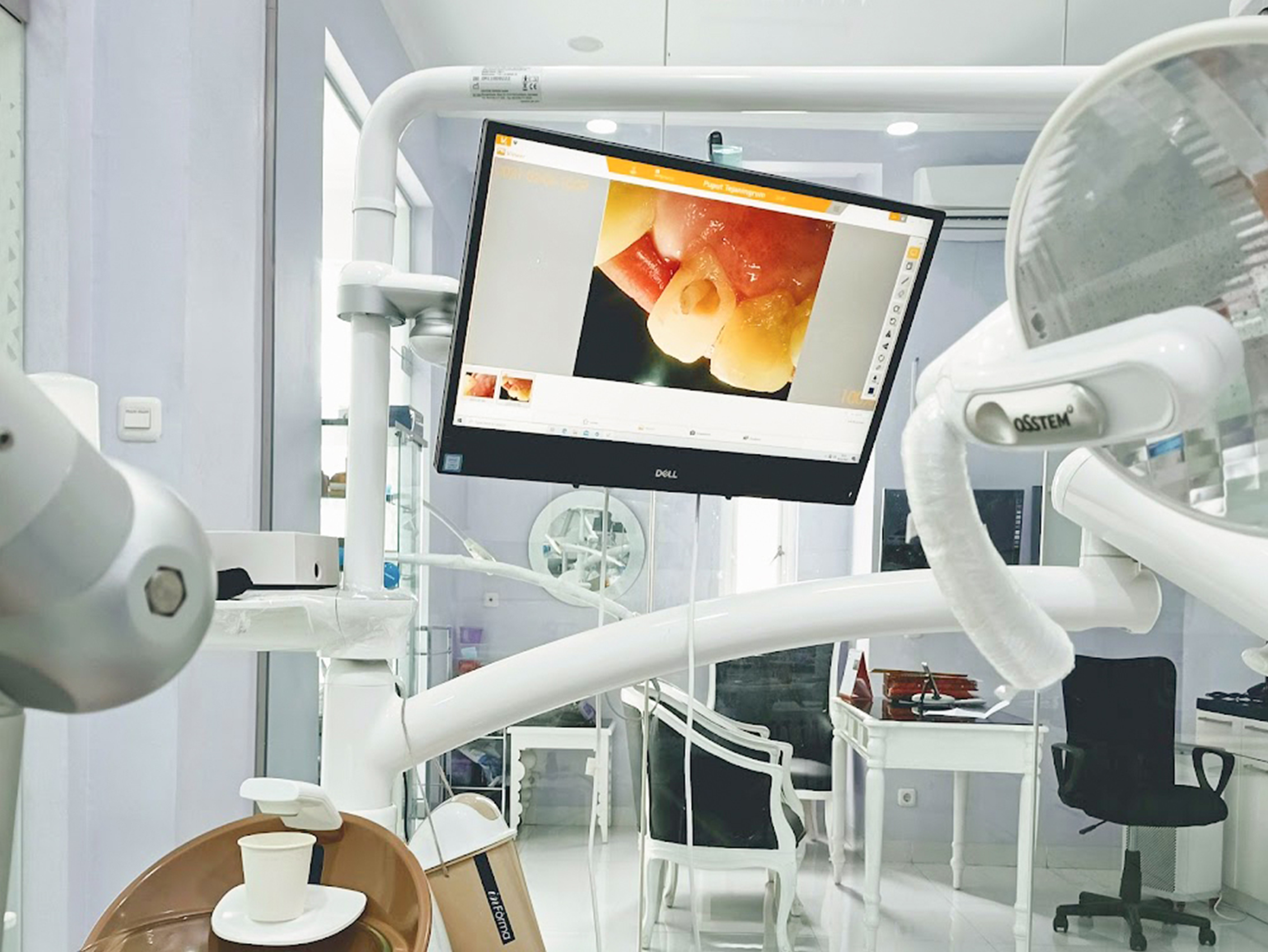 Dental Unit Klinik Grin Dental Narogong 3